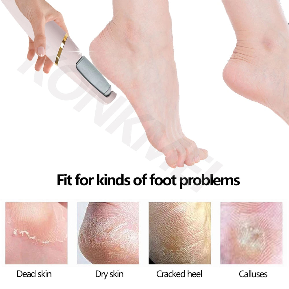 Pedicure Foot  Callus  Remover tool